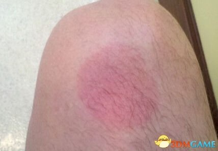 这双淤青腿袜必须拥有 和外面母狐狸不一样的囧图