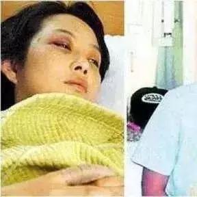 电竞选手浴室意外骨折！揭秘选手康复之路