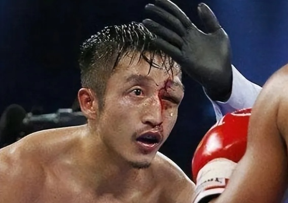 邹市明8年前败北真相：揭秘“被送水工打哭”的背后