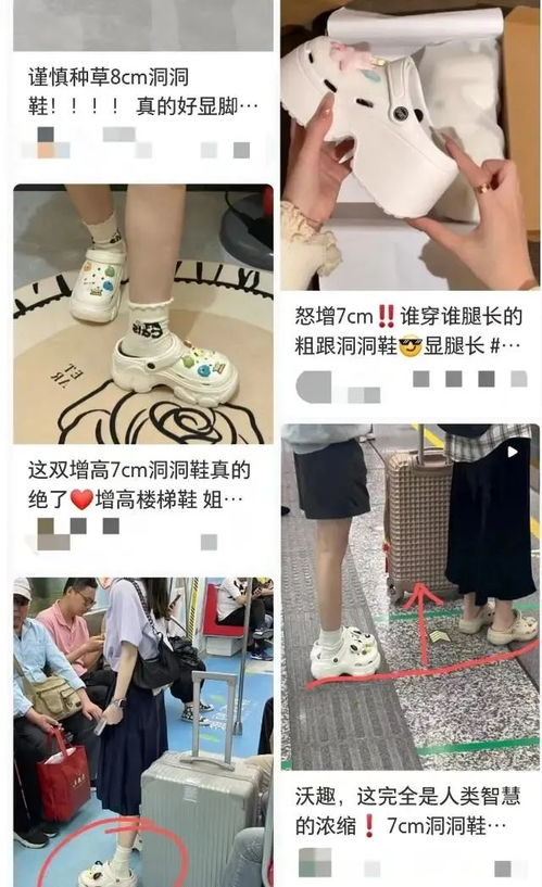 洞洞鞋穿出健康隐患？女子足底长“石头”惊悚揭秘