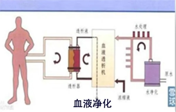 沙丘觉醒：揭秘血液净化器制作攻略