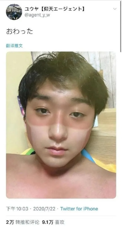 BW韩援Coser晒痕红印引粉丝心疼：真实幕后曝光