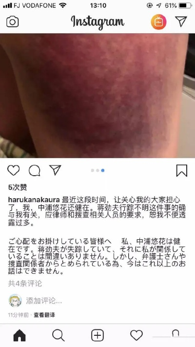 BW韩援Coser晒痕红印引粉丝心疼：真实幕后曝光