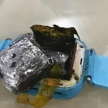 男子裤兜充电宝自燃惨剧：三级烧伤需植皮，玩家警惕！