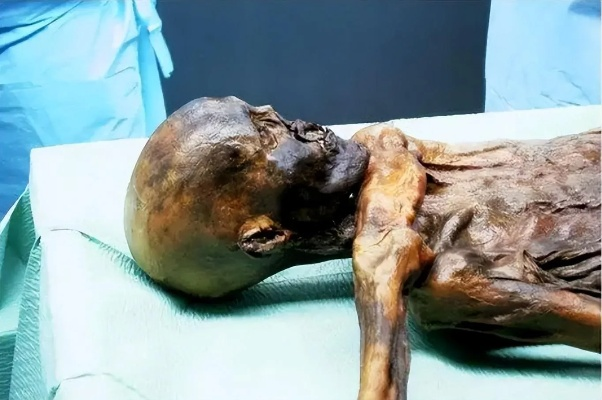 冰封28年：巴基斯坦男子尸体奇迹般保存，揭秘失踪之谜