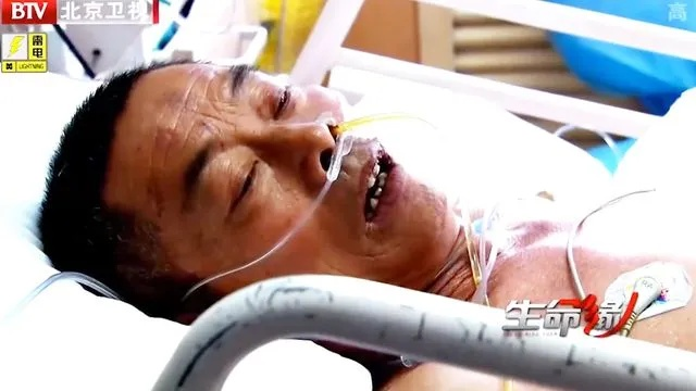 身首断离奇迹康复：意识清醒，双手微抬再现希望