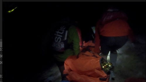 《300秒生死救援！护士咬断甲套，孩子眼中的英雄妈妈》