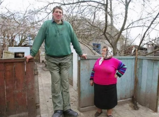 20岁小伙一年猛长25厘米确诊巨人症，身高2米23刷新世界纪录