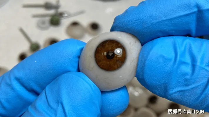 全球最贵义眼诞生：23岁珠宝商用2克拉真钻打造，价值1425万震撼问世