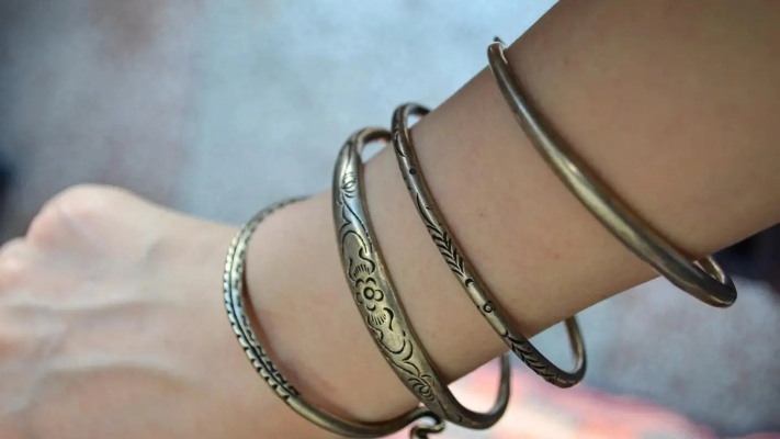 十年戴镯嵌肉痛，揭秘美丽代价警示录