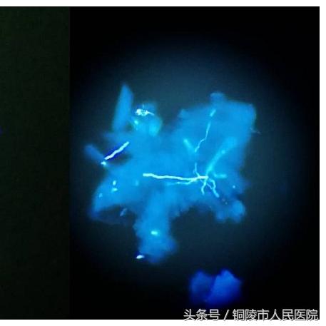 真菌世界孢子战争破译，量子纠缠式占领链的实战应用