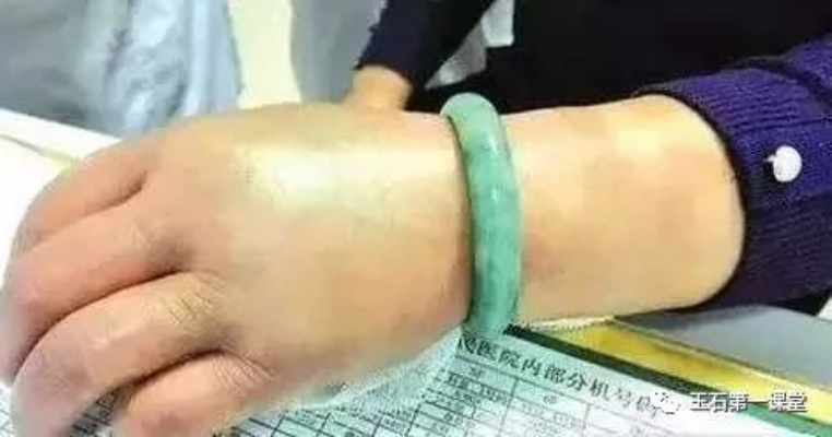 为什么你的青玉萨总是卡手？深度拆解+实战案例